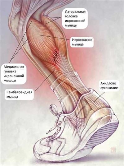 Причины и симптомы разрыва икроножной мышцы